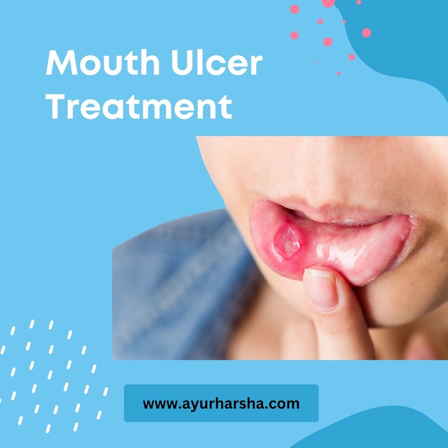 mouth ulcer treatment AyurHarsha