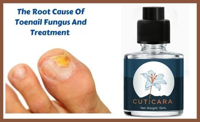 Cuticara Anti-Fungal & Fungus Remover Cuticara