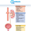 Acute-kidney-injury - Picture Box