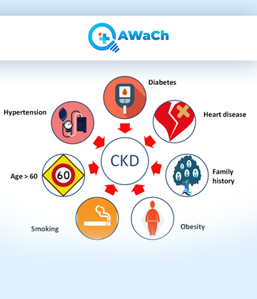 Chronic-Kidney-Disease - Copy Picture Box