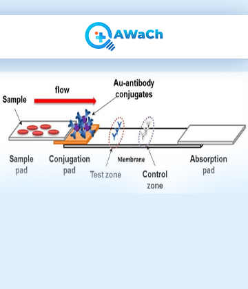 Lateral-Flow-Assay (1) Picture Box