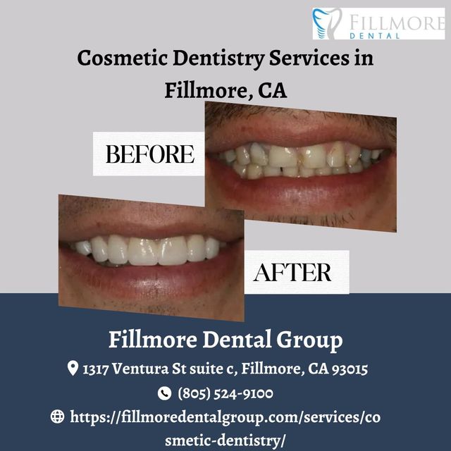 Cosmetic Dentistry Services in Fillmore, CA Picture Box