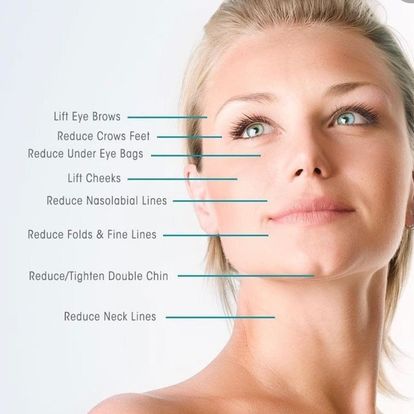 Microneedling in Gig Harbor296135686 1848489272644 Picture Box