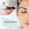 Microneedling in Gig Harbor... - Picture Box