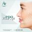 Microneedling in Gig Harbor... - Picture Box