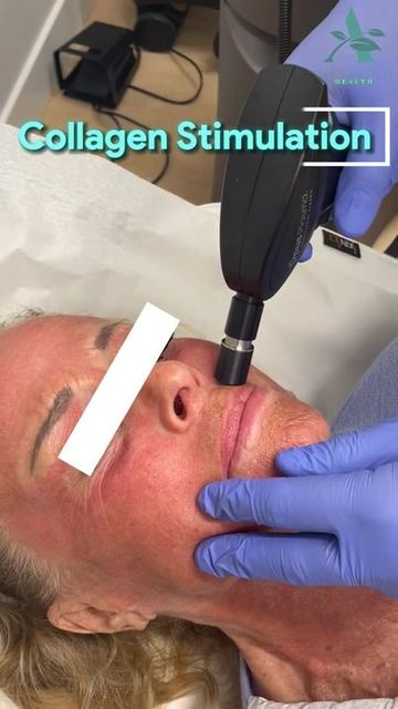 Microneedling in Gig Harbor381958089 2171401613747 Picture Box