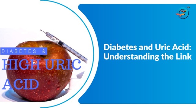 Diabetes & Uric Acid: Symptoms, Causes and Treatme Picture Box