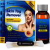 Clean as Teen Skin Tag Remover Serum USA Ingredients, Official Website & Reviews Gummies Reviews