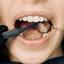 Dentalimplant in Wollongong... - Picture Box