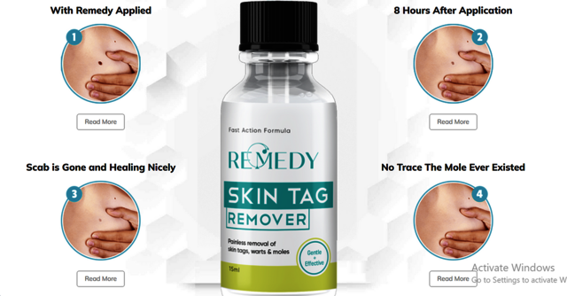 image processing20231127-3502814-8vhvff Remedy Skin Tag Remover USA  Benifits, Official Website & Reviews [2024]