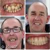 Best dentist in Knutsford - Kissdental Liverpool