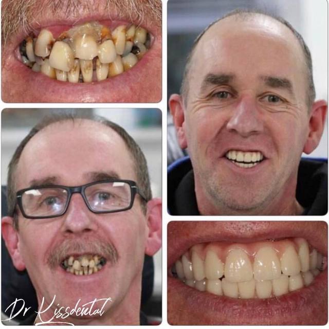 Best dentist in Knutsford Kissdental Liverpool