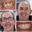 Best dentist in Knutsford - Kissdental Liverpool