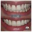 private-dentists-dartford - Kreate Dental Dartford