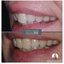 Dental implants Dartford re... - Kreate Dental Dartford