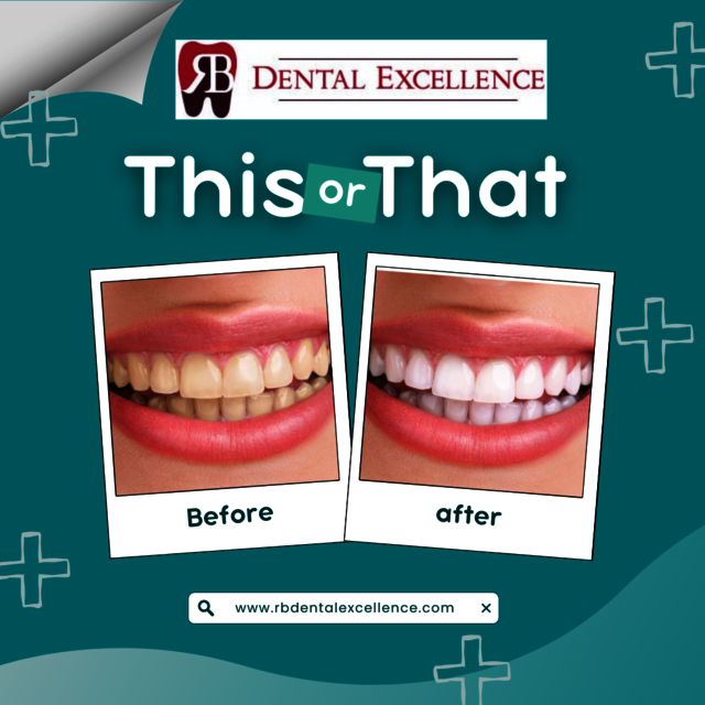 Dentist in Rancho Bernardo dentist in Rancho Bernardo