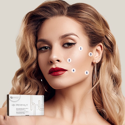 Profhilo skin Skinoza clinic Orpington