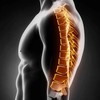 Expert Disc Injury Chiropra... - cameronchiro