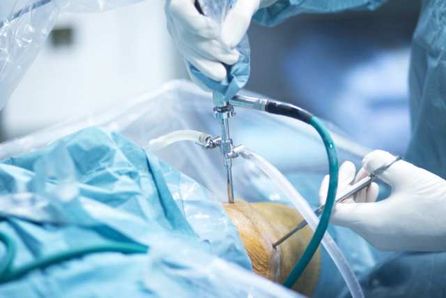 Advanced Arthroscopy Surgery in Jaipur for Joint H Sports Med