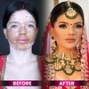 Vitiligo skin makeup At UK ... - UK International