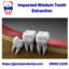Impacted Wisdom Tooth Extra... - GIS Classic