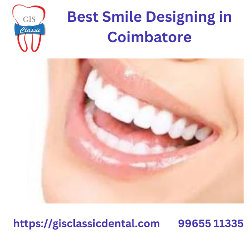 Best Smile Designing in Coimbatore | Dental Veneer GIS Classic
