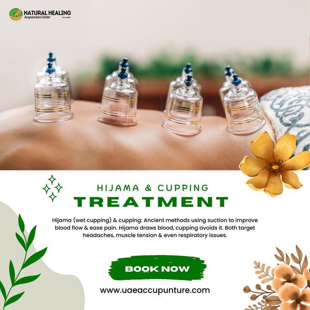 hijama therapy hijama therapy