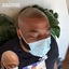 c1 - SCALPMICRO Scalp Micropigmentation Calgary