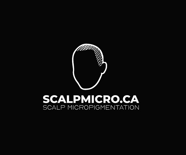 c11 SCALPMICRO Scalp Micropigmentation Calgary