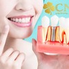 Comprehensive Dental Servic... - CNG DENTAL