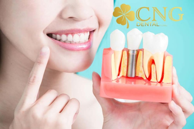 Comprehensive Dental Services and Medical Tourism  CNG DENTAL