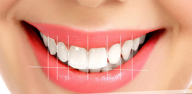 AydÄ±n GÃ¼lÃ¼mseme TasarÄ±mÄ± CNG DENTAL