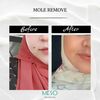 434215015 1226923201620076 ... - Meso Aesthetic Alor Setar -...