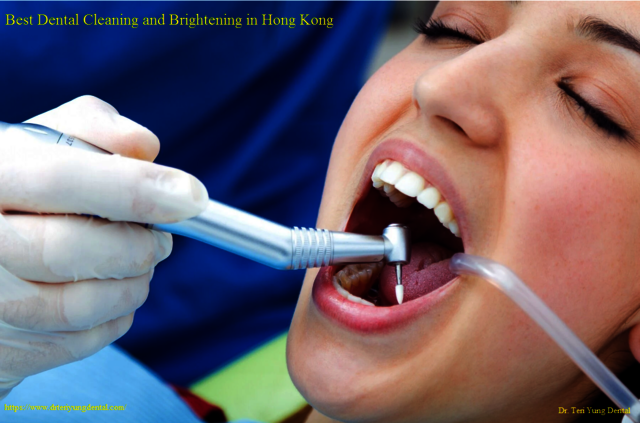 tooth cleaning Dental Care