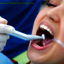 tooth cleaning - Dental Care