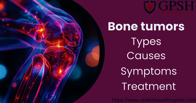 Bone tumors Picture Box