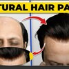 hair patches for men - Picture Box