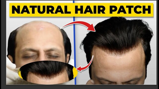 hair patches for men Picture Box