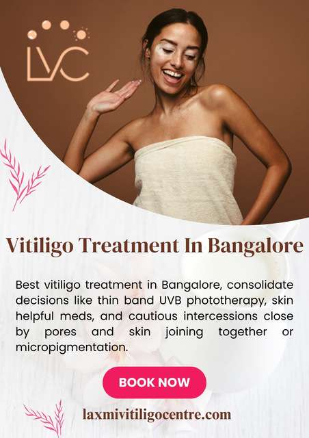 Vitiligo Treatment In Bangalore Picture Box