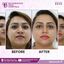 face hospital - Best face hospital in India