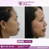 facemakeover - Best face hospital in India