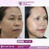 facemakeover1 - Best face hospital in India