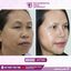 facemakeover1 - Best face hospital in India