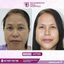 facemakeover2 - Best face hospital in India