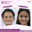 dental - Best face hospital in India