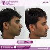 jaw surgery - Best face hospital in India