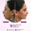 jaw surgery 1 - Best face hospital in India