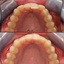 Cosmetic dentist East Grins... - The Smile Gallery