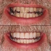 Dentist in East Grinstead - The Smile Gallery