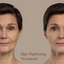 skin-tightening-treatement - Picture Box